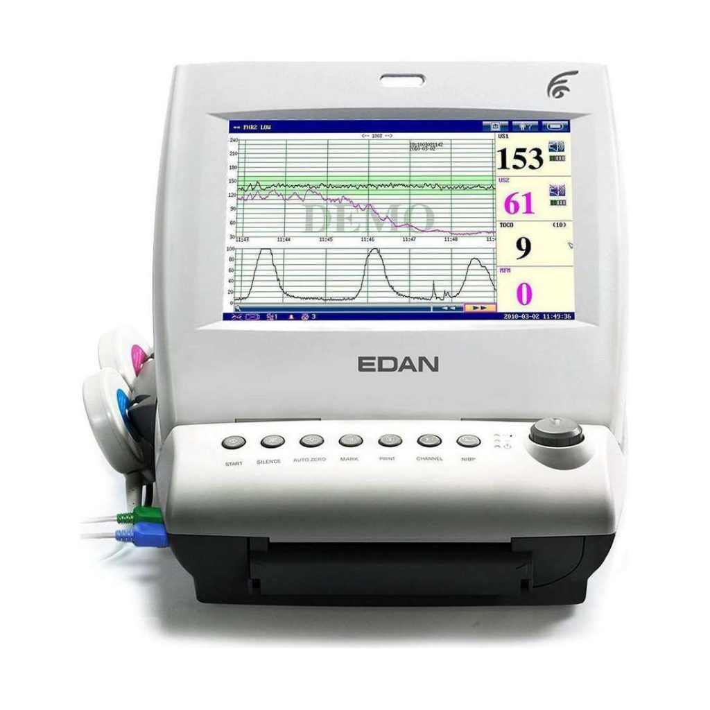 MONITOR FETAL