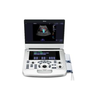 SISTEMA DE DIAGNÓSTICO ULTRASONIDO ECÓGRAFO